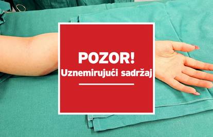 EKSKLUZIVNO Dijete stradalo na A3. Čudesnim zahvatom na Rebru spasili joj smrskanu ruku